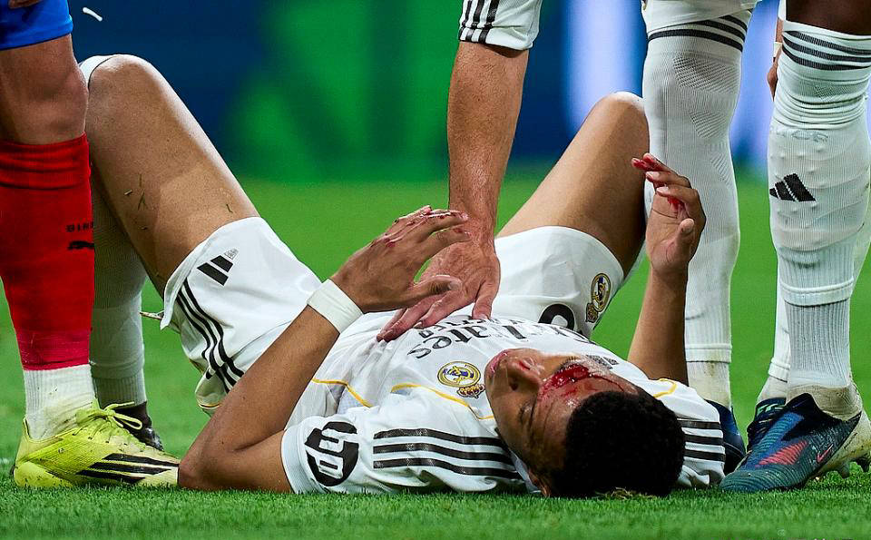 争议再起!姆巴佩受伤流血,主裁拒判点球,皇马官方强烈指责西甲暗箱操作